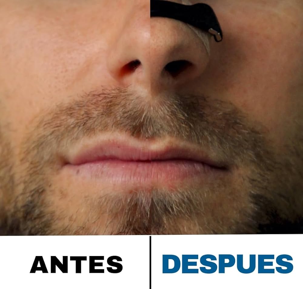 TIRAS MAGNETICAS ANTIRONQUIDOS/MEJORA LA RESPIRACIÓN