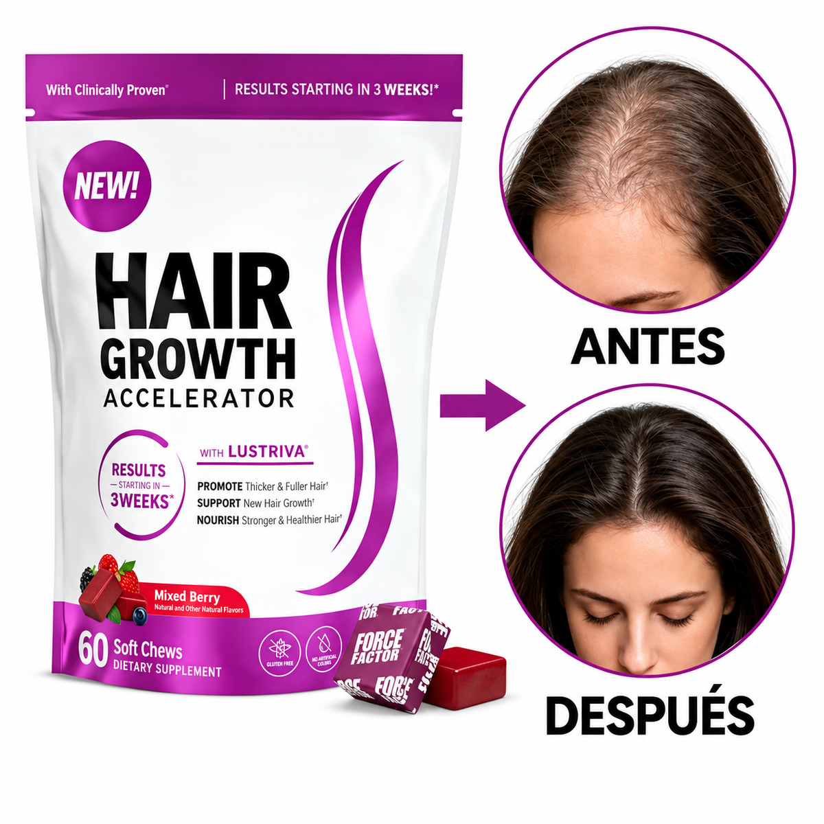 GOMITAS PARA CRECMIENTO DEL CABELLO - con Lustriva®