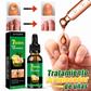7 Dias Tratamiento para Hongos Uñas – Pies y Manos (30 ml)