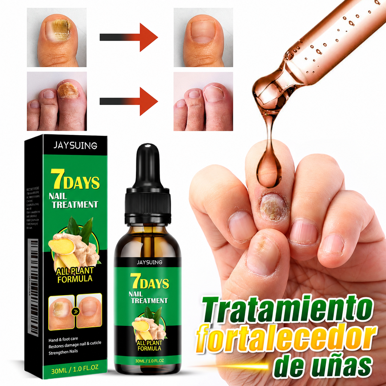 7 Dias Tratamiento para Hongos Uñas – Pies y Manos (30 ml)