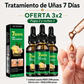 7 Dias Tratamiento para Hongos Uñas – Pies y Manos (30 ml)