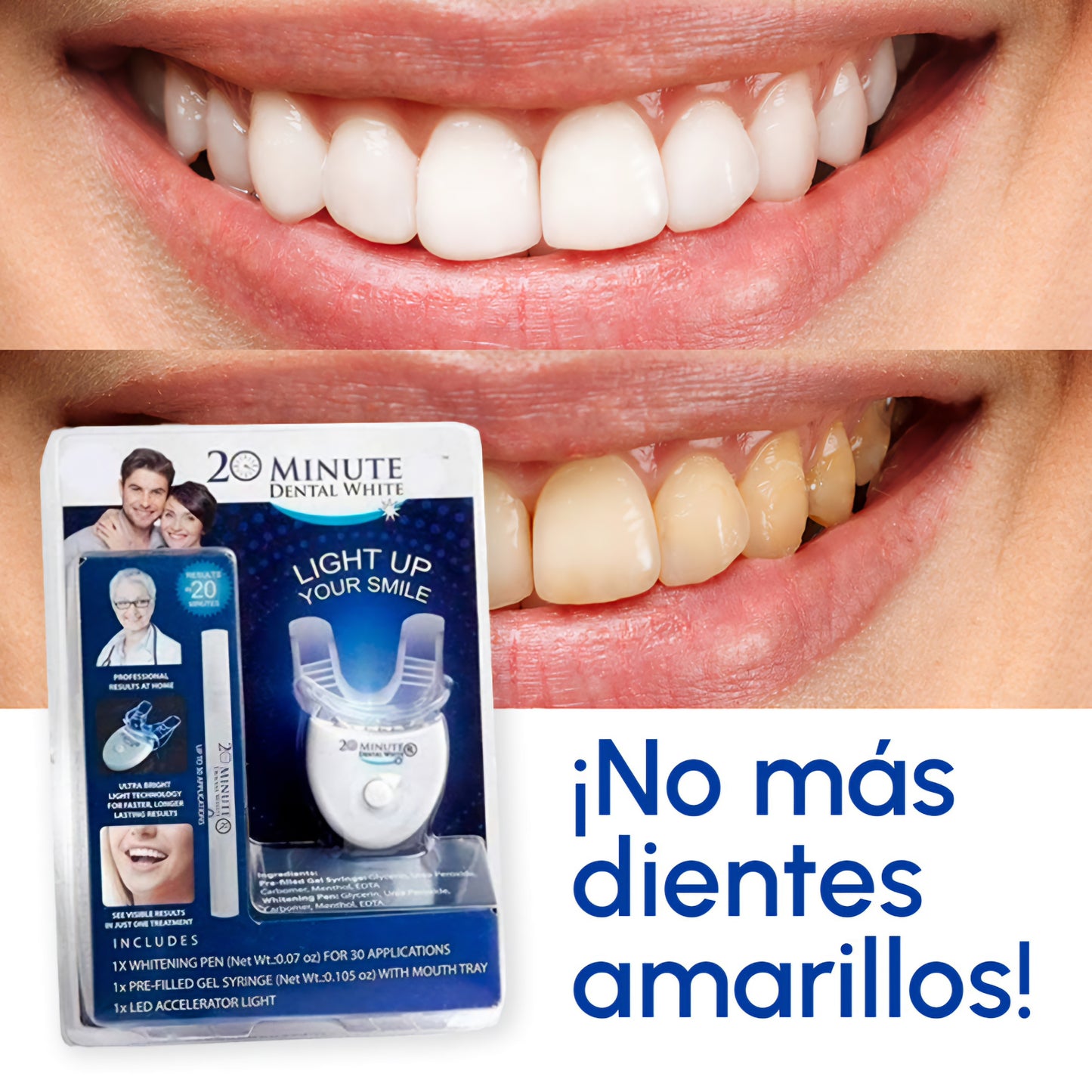 Blanqueamiento dental 20 MINUTE - Dental White RX